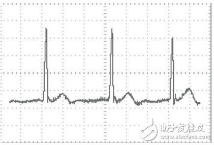 基于STM32芯片和TFT-LCD的便攜式心電圖儀設(shè)計(jì)
